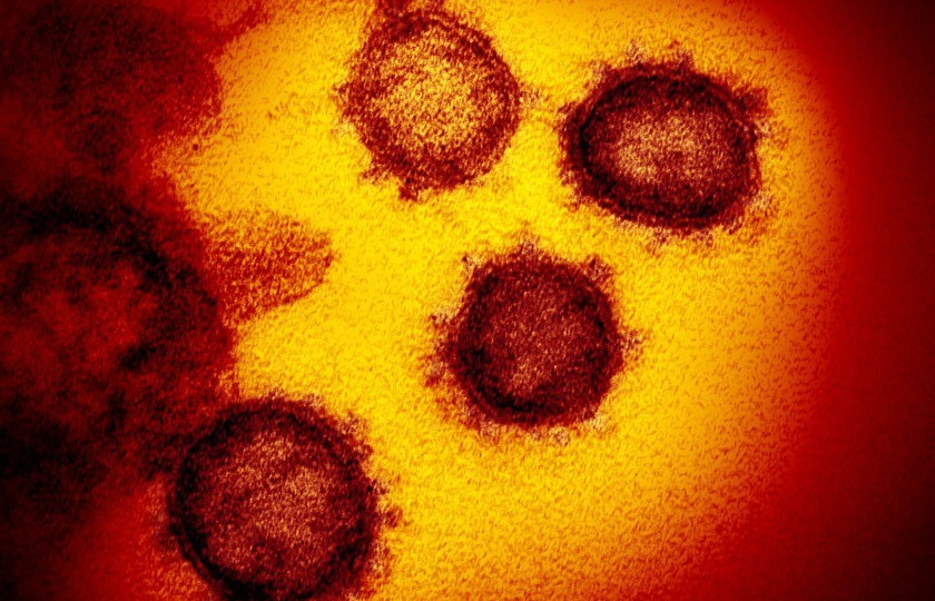 coronavirus.jpeg